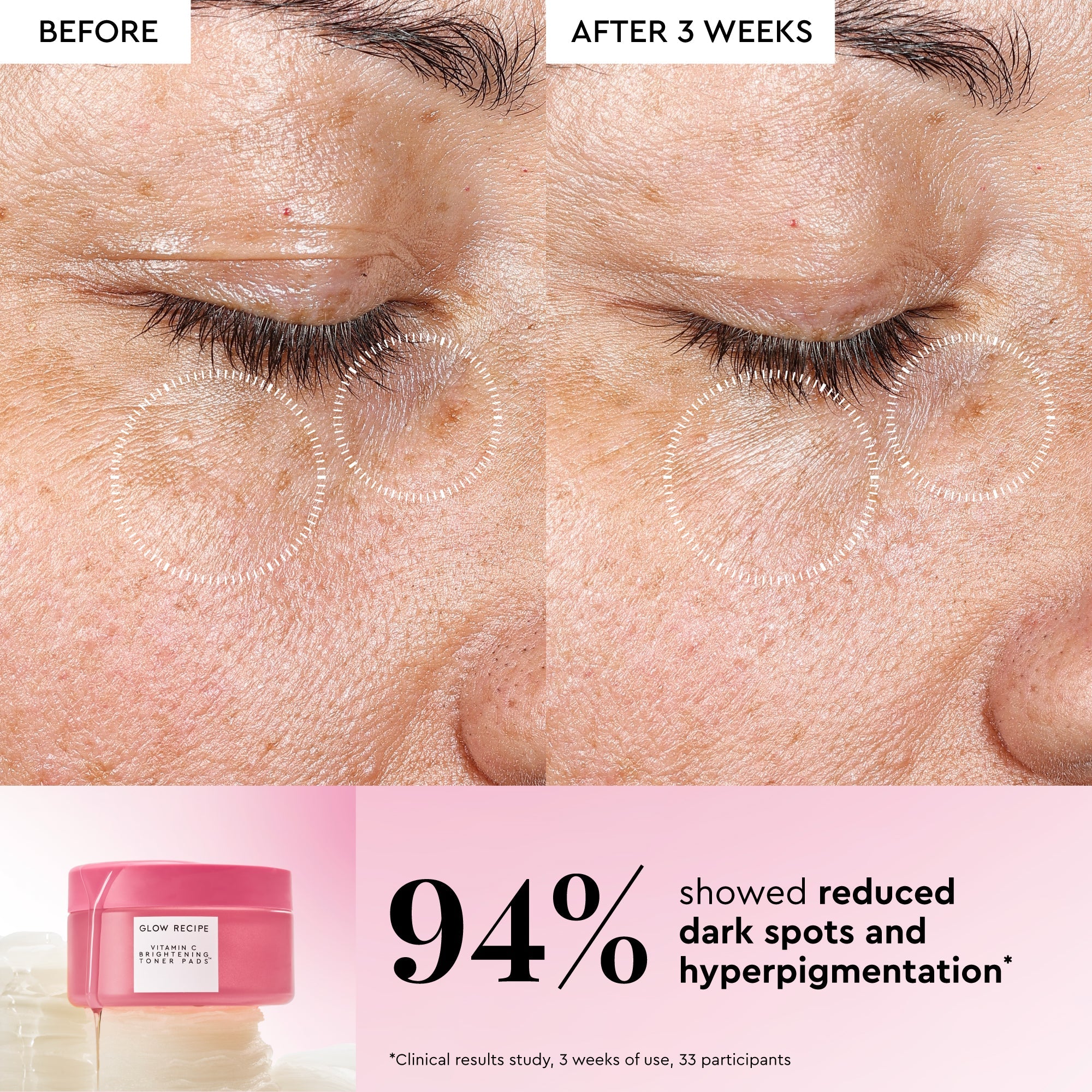 Korean Toner Pad Multi-Masking Kit