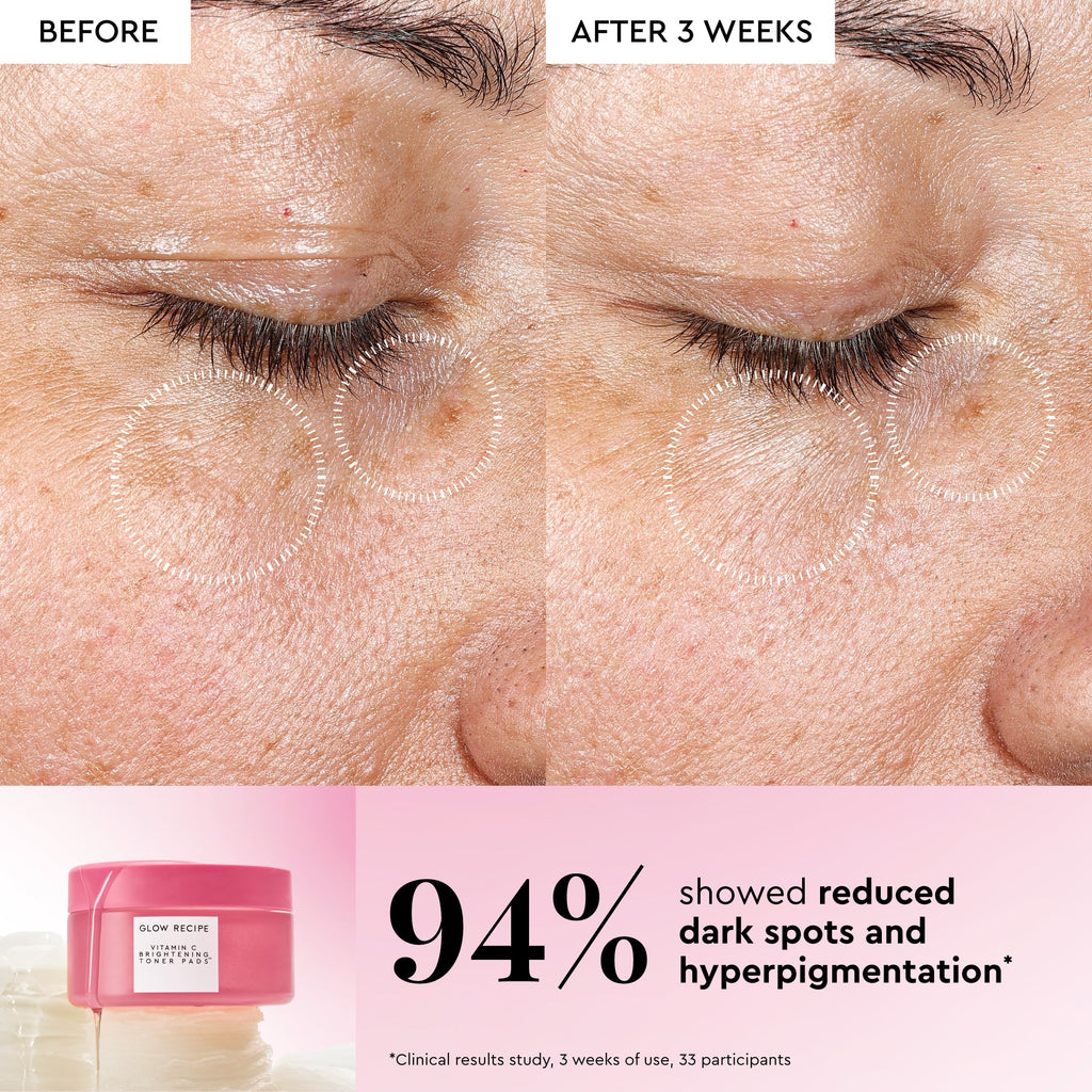 Korean Toner Pad Trial & Travel Kit